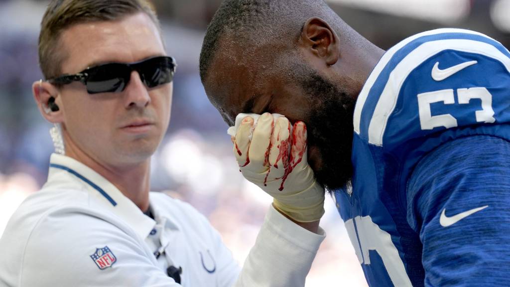 Colts’ Shaquille Leonard exits after nasty collision with teammate