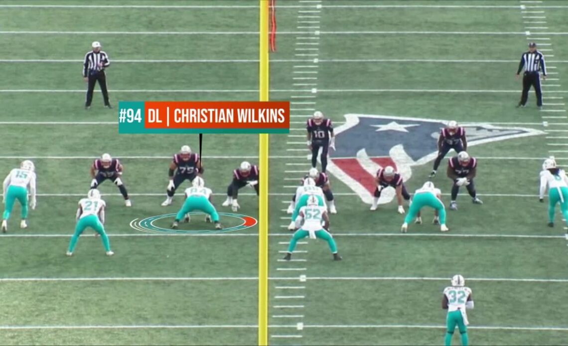Baldy's Breakdown | Jets D-Line vs. Dolphins O-Line